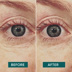 Apricot Beauty � Vitamin C Eye Pads, 2 stk