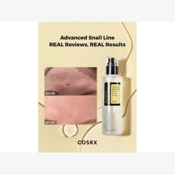 CosRX � Advanced Snail 96 Mucin Essence 100ml - K-Beauty